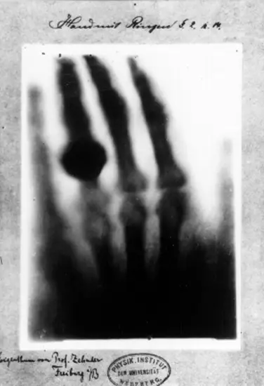 A kid's (or immature adult's) guide to x-rays. 1 image thumb62