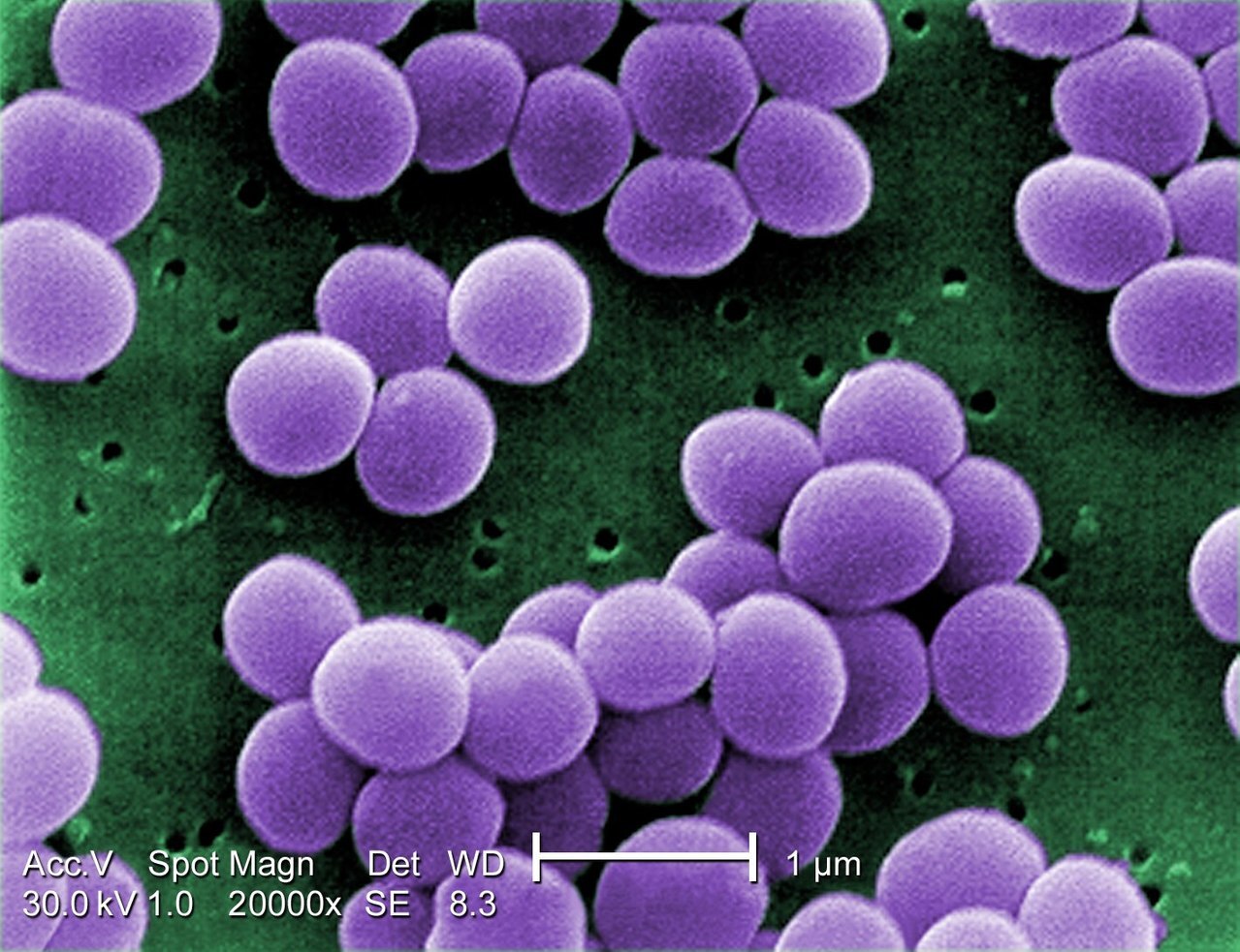 Staphylococcus aureus bacteria