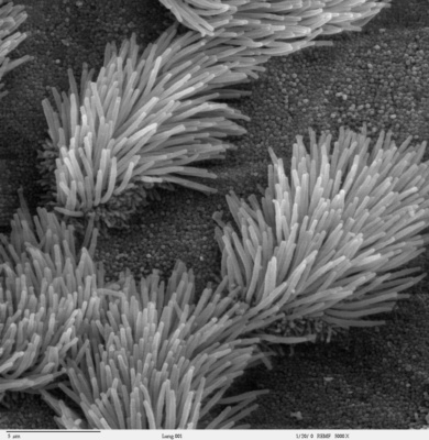 Lung trachea epithelium with cilia projecting from it
