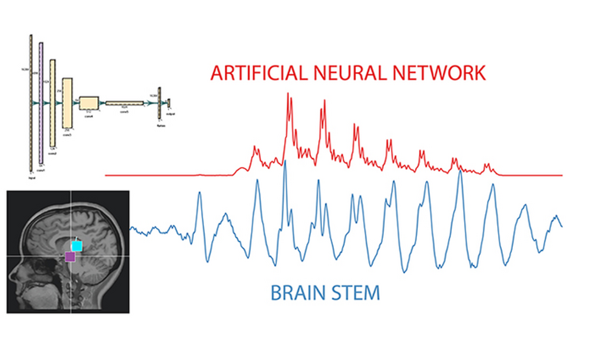 AI waves closely resemble brain waves
