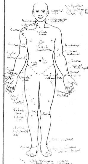 Michael jackson's leaked autopsy reports confirm the horrifying facts we already knew. 1 image thumb 100