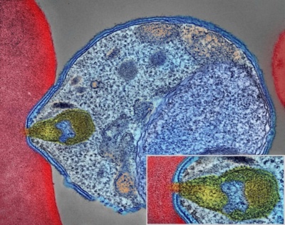 Malaria parasite attaching to a human red blood cell